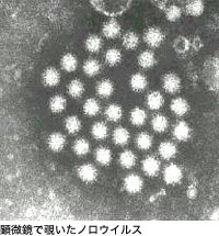 顕微鏡で覗いたノロウイルス